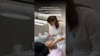Контурная пластика губ