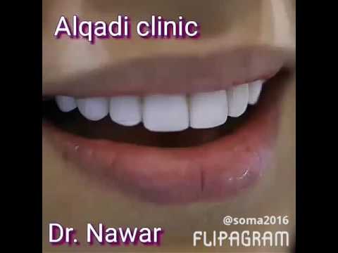 عيادات القاضي لطب الأسنان لأفضل ابتسامة