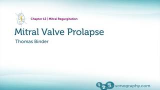 Mitra Valve Prolapse Echocardiogram basic principle and Echocardiography demonstration