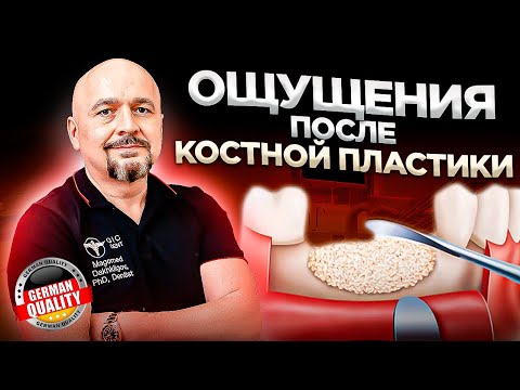 Костная пластика- ощущения и дискомфорт после проведения операции