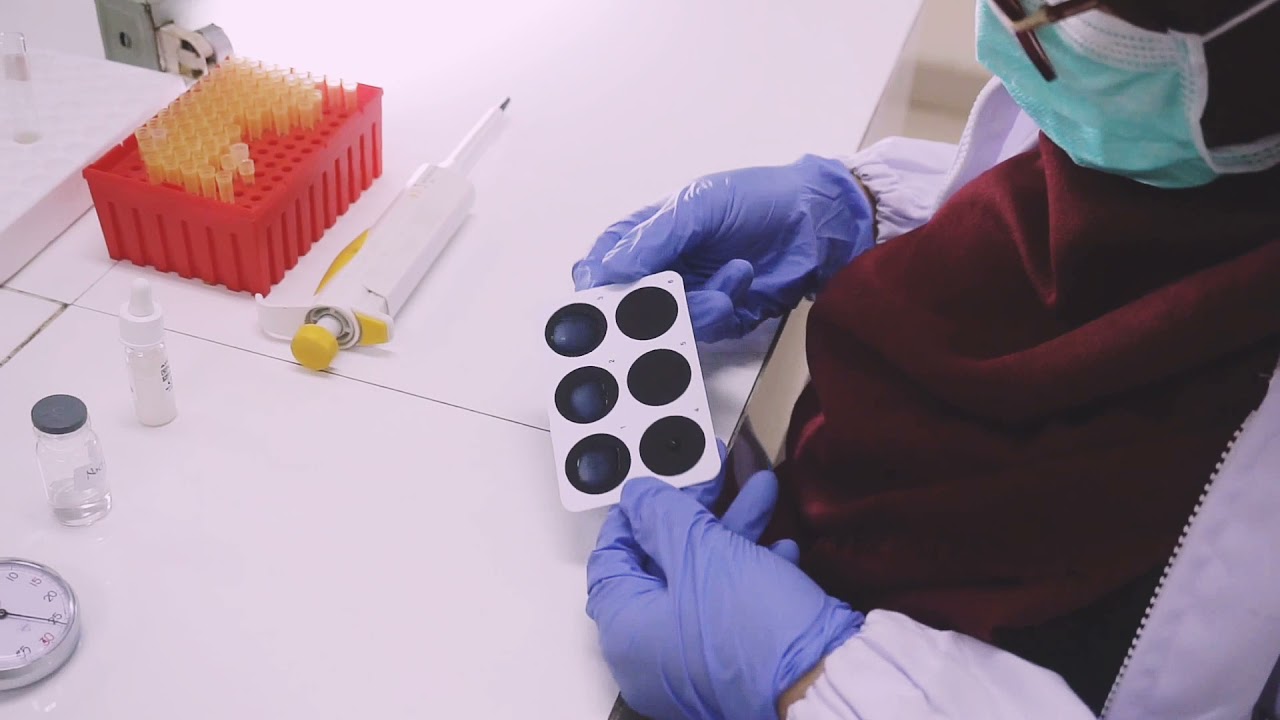 VIdeo Pemeriksaan Anti Streptolisin O (ASTO)