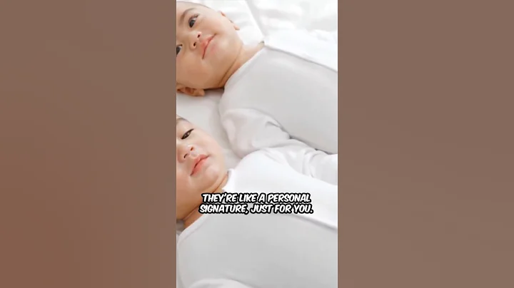 Not even identical twins share the same ones! 🤯 #shorts #facts #youtubeshorts