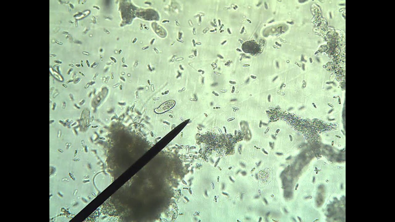 Protists- Amoeba, Euglena, Paramecium - YouTube