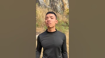 How I Cured a Bug Bite with Yogurt in the Wild | Survival Hacks 👃👀😂 #funny #shorts #survivalskills