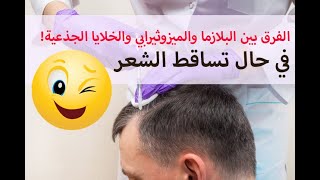 الفرق بين #البلازما و #الميزوثيرابي و #الخلايا_الجذعية في حال تساقط الشعر