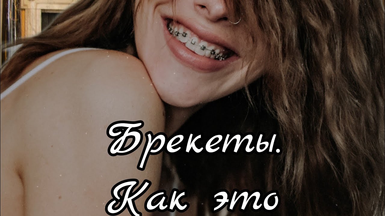 Как работают брекеты. - YouTube