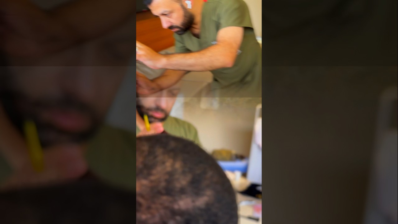 Afro Hairline Design by Dr.Caymaz
