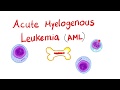 Acute Myeloid Leukemia (AML) | Auer Rods | Myeloperoxidase Positive