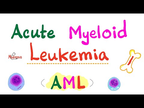 Acute Myeloid Leukemia (AML) | Auer Rods | Myeloperoxidase Positive