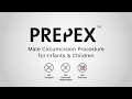 Prepex nonsurgical procedure for infants and children 3d