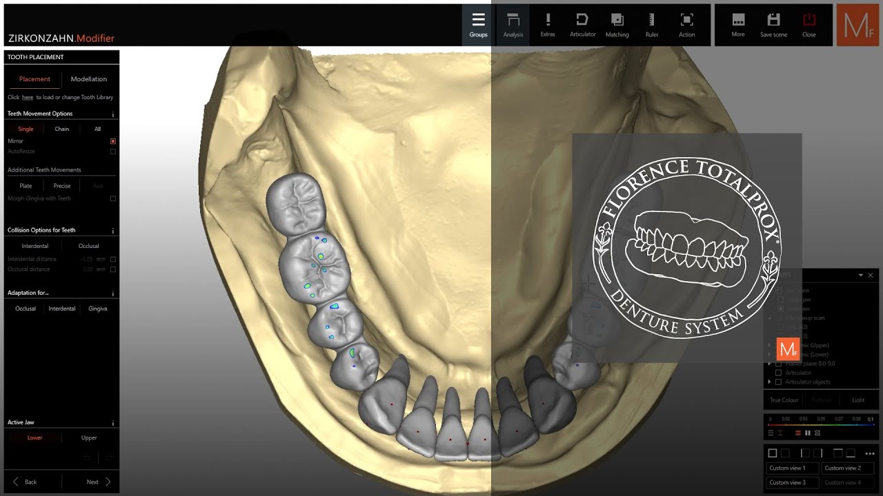 One library. Full control. | Zirkonzahn.Modifier