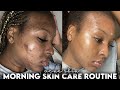 MORNING SKINCARE ROUTINE FOR ACNE PRONE & TEXTURED SKIN | NO ACCUTANE | KENSTHETIC