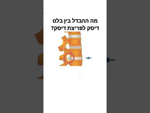 וִידֵאוֹ: מה ההבדל בין תושב למטפל?