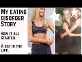My Story:  Anorexia & Binge Purge Disorder