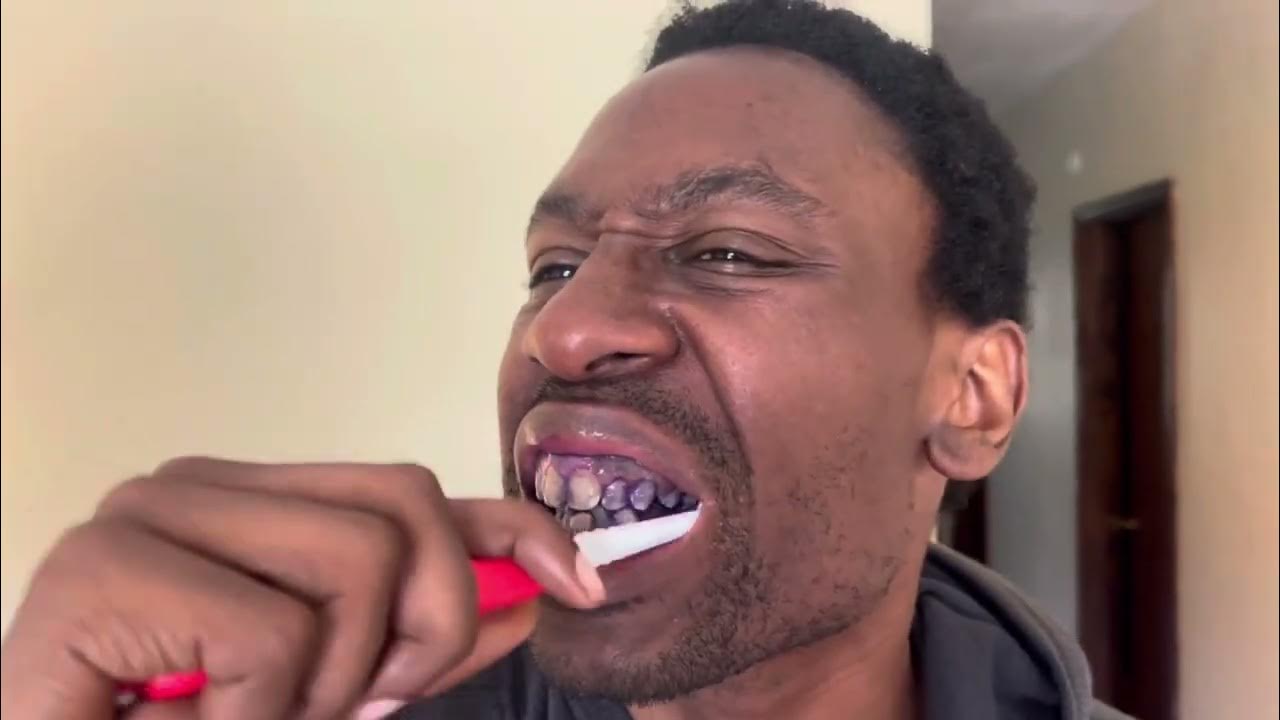 Putting Hismile serum to the ultimate test! (First use) YouTube