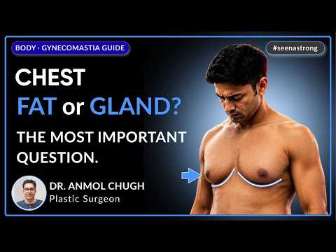 Video Gym Didn't Fix His Chest… This Did! | Gynecomastia Real Story