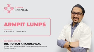 Causes And Treatment Of Armpit Lumps In Hindi By Dr. Rohan Khandelwal Ck Birla Hospital
