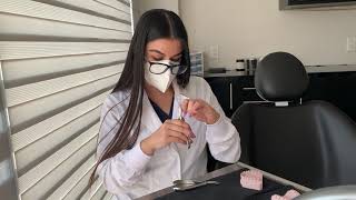 Festoneado De Encía Superior