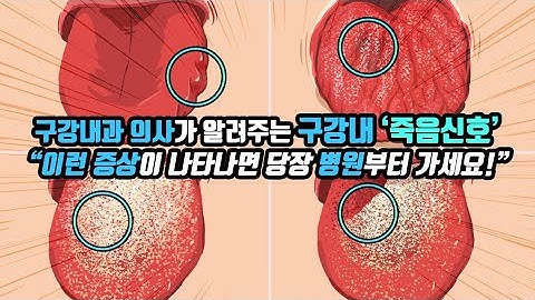 구내염, 구강암, 구강내과의사가 말해주는 진짜 구강병 이야기(feat.위험한 입병과 안심해도 될 때)