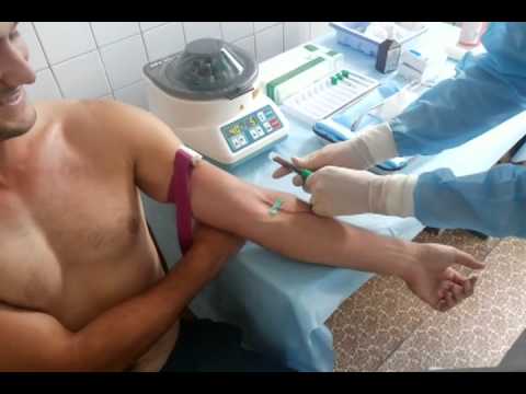 Стадии варикозного расширения вен нижних конечностей