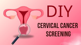 DIY Cervical Cancer Screening: The Future of Women's Health Care
