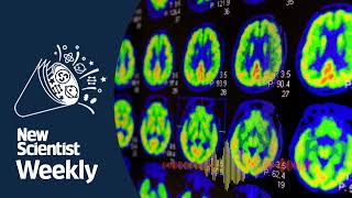 Most detailed map ever of the human brain | New Scientist Weekly podcast 219 screenshot 5