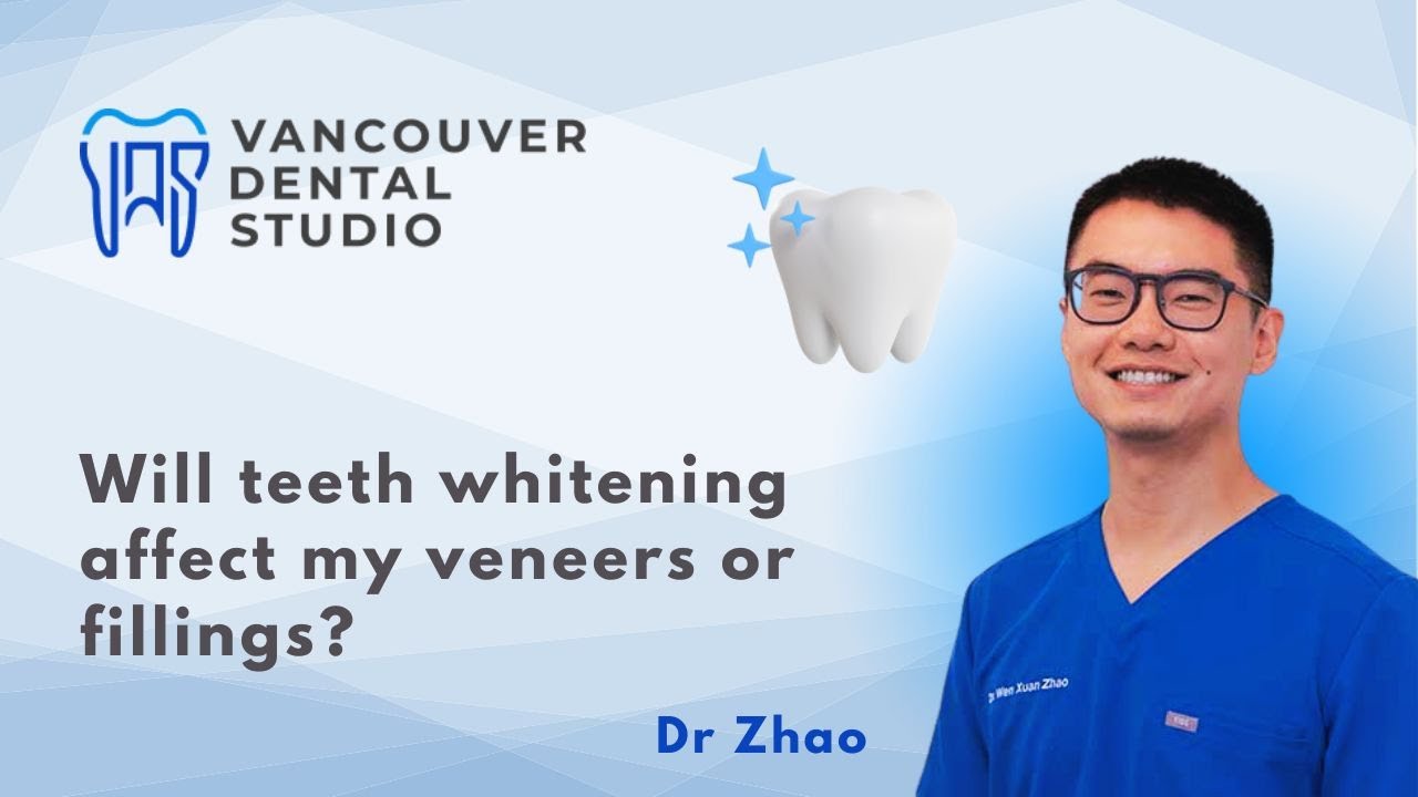Vancouver Dental Studio - Will teeth whitening affect my veneers or fillings?