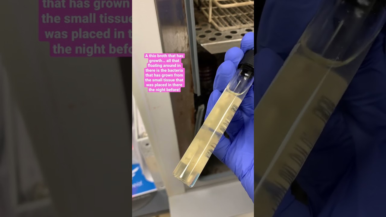 Thio broth with growth 24 hours later