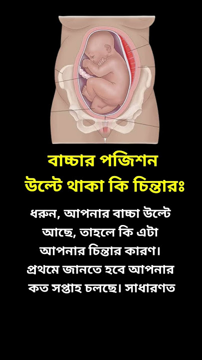 বাচ্চার উল্টো পজিশন কি চিন্তার বিষয়? #pregnancy #গর্ভবতী #Wombbabyposition #babyposition