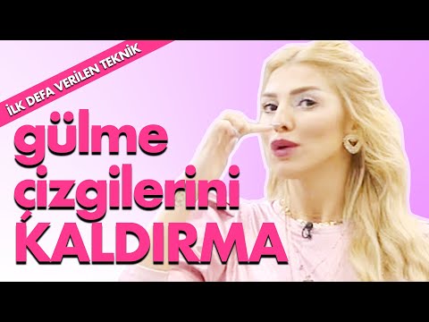 Gençleştiren yüz tekniği | Yüz sarkmasını giderme | Üst dudağı kaldırma | Gülme çizgilerini geçirme