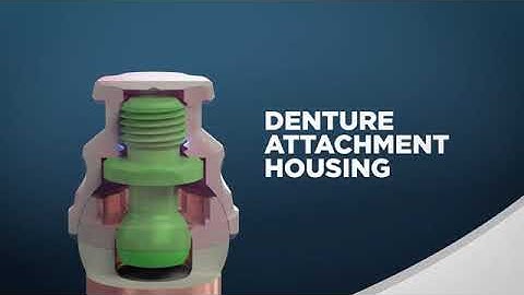 Introducing LOCATOR FTx  Animation cut