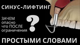 видео: Синус лифтинг. Открытый и закрытый. После синус лифтинга картинка: Синус лифтинг. Открытый и закрытый. После синус лифтинга