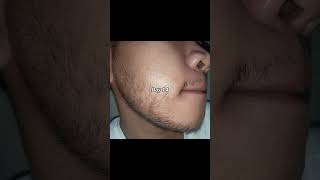 Filipino Beard Journey 15 Week Transformation