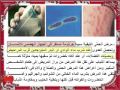 الأمراض الناتجة عن تلو ث المياه والوقاية منها