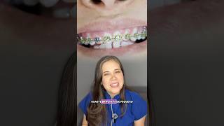 Se movieron tus dientes? #brackets #dentista #odontologia #viral #greenscreen #subscribe #limaperu