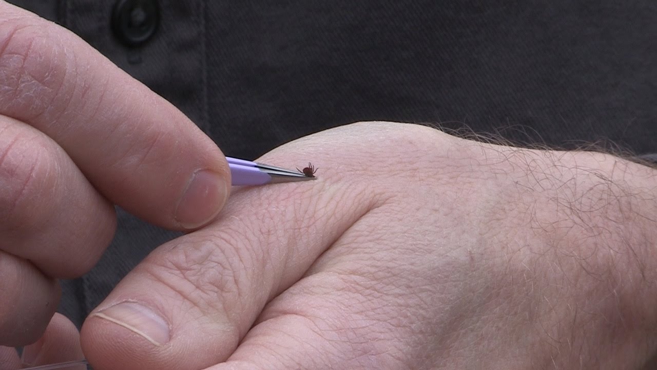 How to Remove a Tick - YouTube