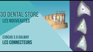 [EXOCAD] Nouveautés Exocad GALWAY : la modélisation des connecteurs avec le multi view design