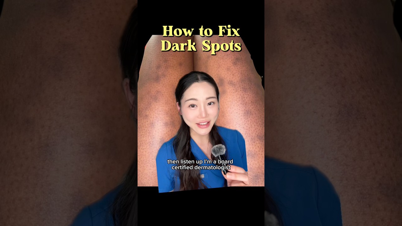 How to fix dark spots 
