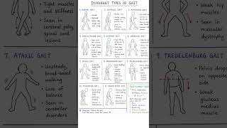 Gait analysis #physiotherapy #healinghandsphysio #physiotherapystudent