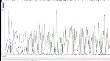 Video Tutorial Contiq Sequence DNA/Konsensus Sekuen DNA menggunakan program Bioedit Kelompok 1