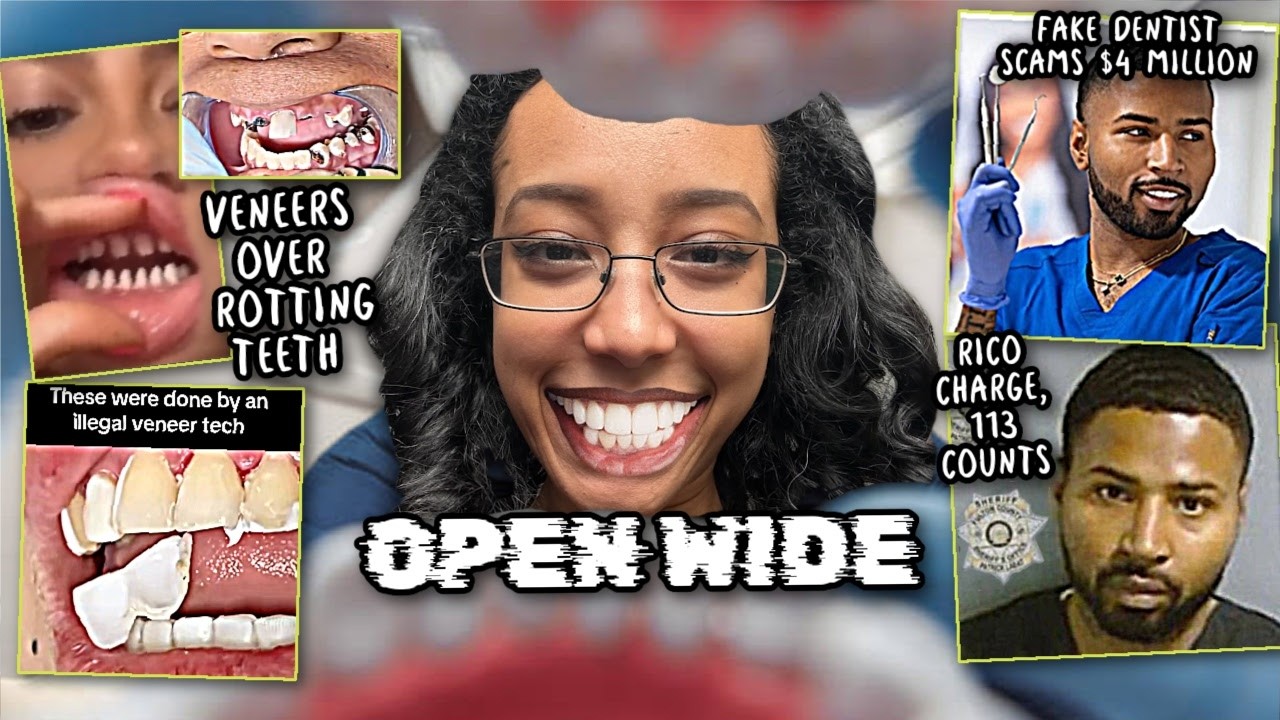 Your natural teeth CAN’T be THAT bad 😬- The Rise of Veneers & The Veneer Tech Scam