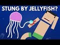 What Happens If You Get Stung By a Jellyfish?