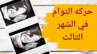 حركة التوأم في الشهر الثالث | كيف تكون حركة التوأم في الشهر الثالث