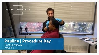 Transformative Hair Restoration Procedure Day for African American Woman | Dr. Blumenthal (Pauline)