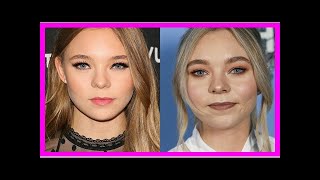Actress Taylor Hickson sues production company over on-set disfigurement