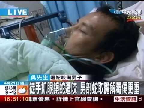徒手抓眼鏡蛇遭咬 取蛇膽解毒傷更重