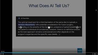 Sheeraz Qureshi MIS Decompression Is the Optimal Treatment