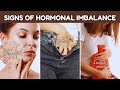 5 signs of hormonal imbalance you should never ignore