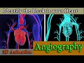 How angiography works complete step by step 3d animated visual guide