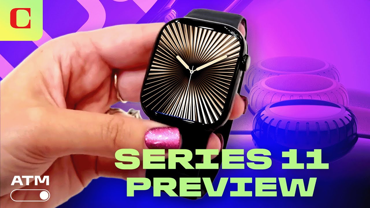 Apple Watch Series 11: What to Expect | All Things Mobile